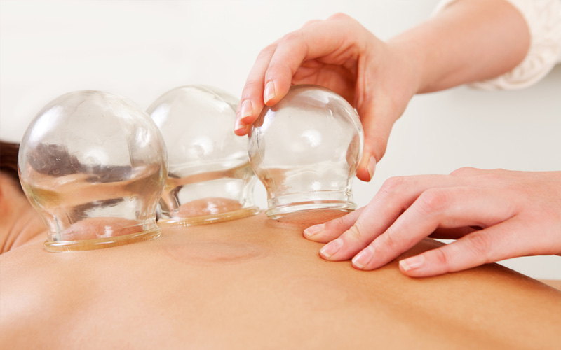 Anti cellulites cupping body treatment